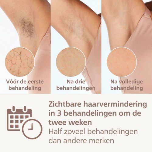 IPL hårfjerner Philips Lumea BRI946/00 - hvid