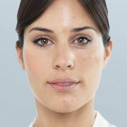 Moispa + Pore·Off - elektrisk ansigtsdamper og hudormefjerner, hvid/rosa